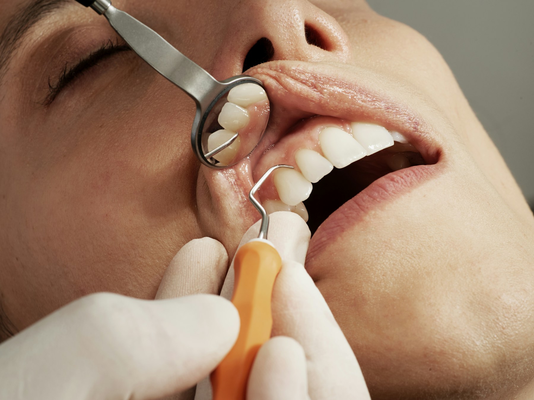 Close-up dental examination with a mirror and tool